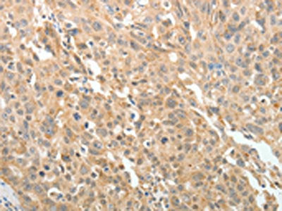 MAP4 Antibody