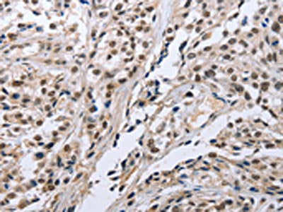 FN1 Antibody