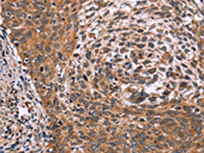 ING2 Antibody