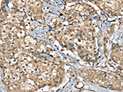 SGPL1 Antibody
