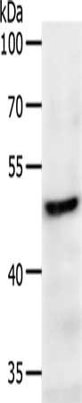 PDK2 Antibody