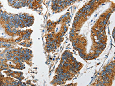 MARK2 Antibody