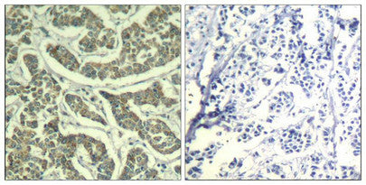 ATR (Ab-428) Antibody