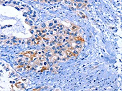 CDK2 Antibody