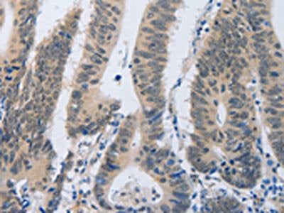 F2R Antibody