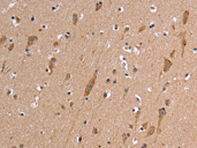 ETFB Antibody