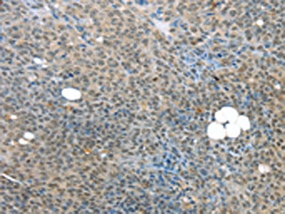 MED15 Antibody