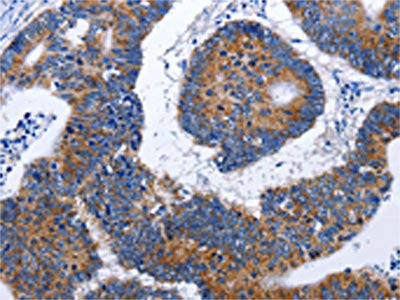EEF1G Antibody