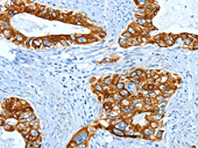 KRT40 Antibody
