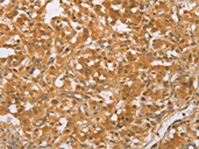 CEBPB Antibody