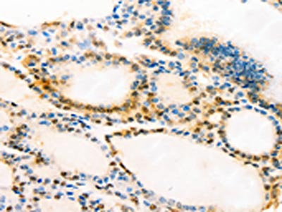 MUC16 Antibody