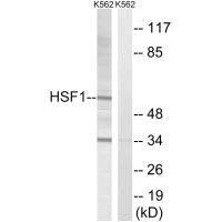 HSF1 (Ab-142) Antibody