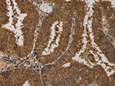 TAB1 Antibody
