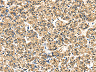 ME1 Antibody