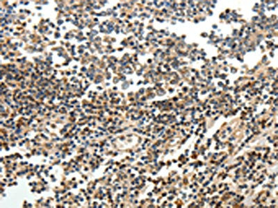 SERPINF1 Antibody