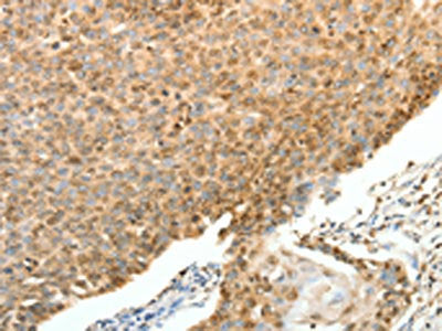 SPAG8 Antibody