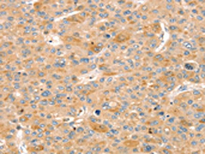 SLIT3 Antibody