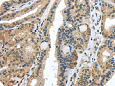 USP28 Antibody