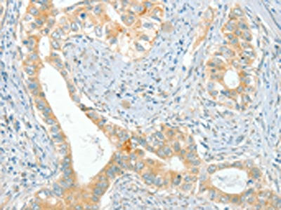 ACE Antibody