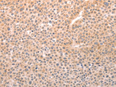 TRPC3 Antibody