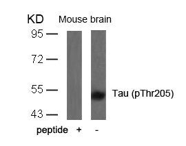 Phospho-MAPT (Thr205) Antibody