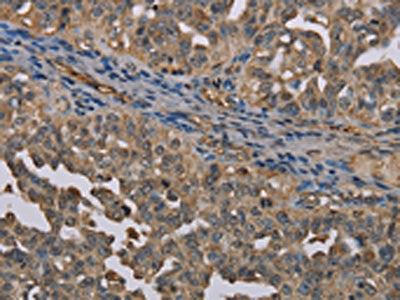 UBP1 Antibody