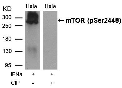 Phospho-MTOR (Ser2448) Antibody
