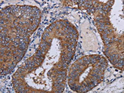 NDUFA1 Antibody