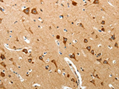 BIRC6 Antibody