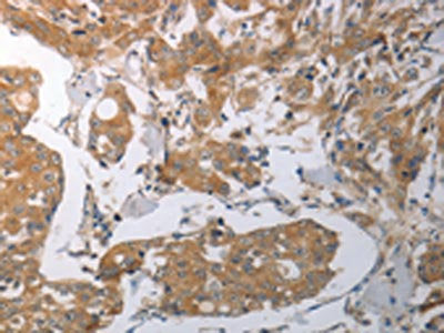SHH Antibody