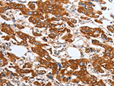 MAPT Antibody