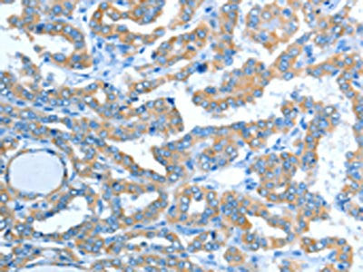 ALDH3B1 Antibody
