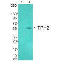 TPH2 (Ab-19) Antibody