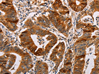 ALDH3A1 Antibody