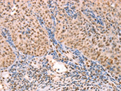 PTMA Antibody