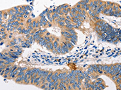 MTOR Antibody