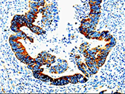IL23R Antibody
