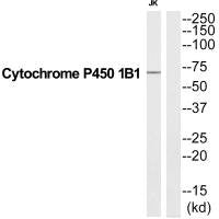 CYP1B1 Antibody