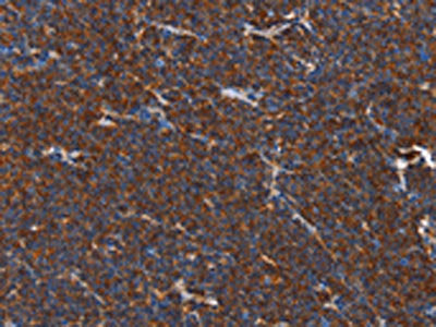 PLK3 Antibody
