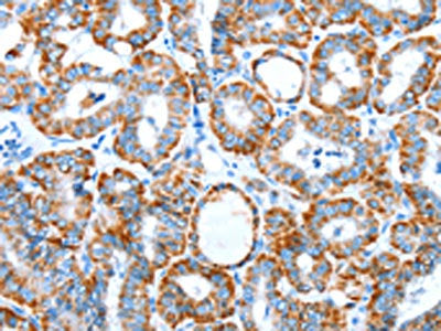 ALDH5A1 Antibody