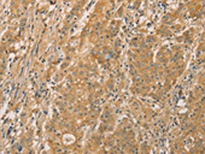 SNAP91 Antibody