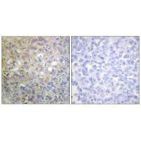 FGFR1 (Ab-766) Antibody