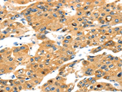 TBX18 Antibody