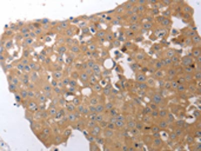 SIRT5 Antibody