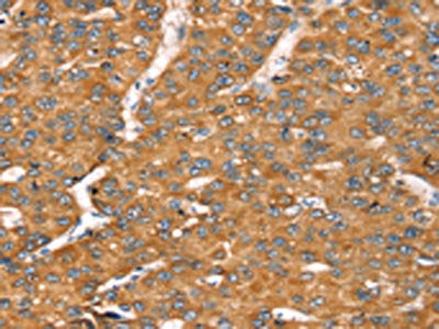 TGFB2 Antibody