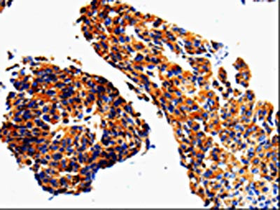 ADD1 Antibody