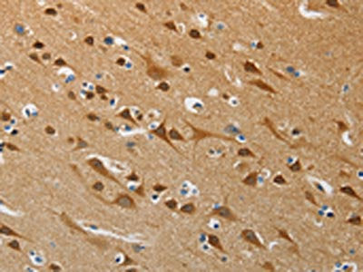 ATG4B Antibody