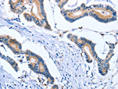PLK3 Antibody