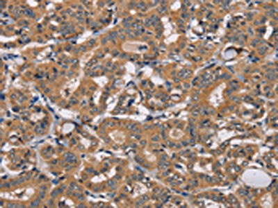 TRAFD1 Antibody