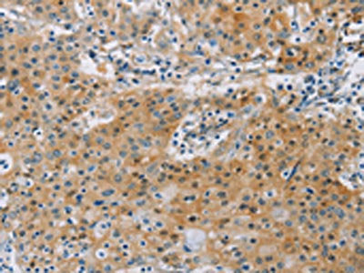 KCNMA1 Antibody